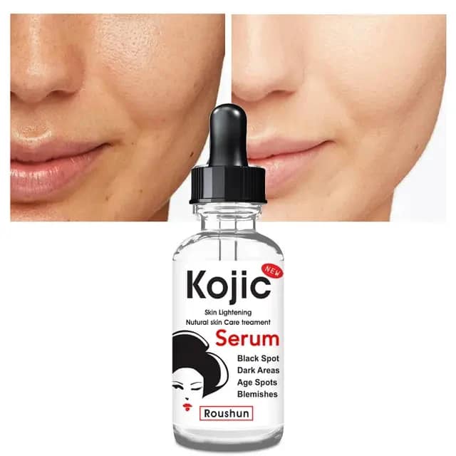 ROUSHUN Kojic Skin Lightening Black Spot Face Serum