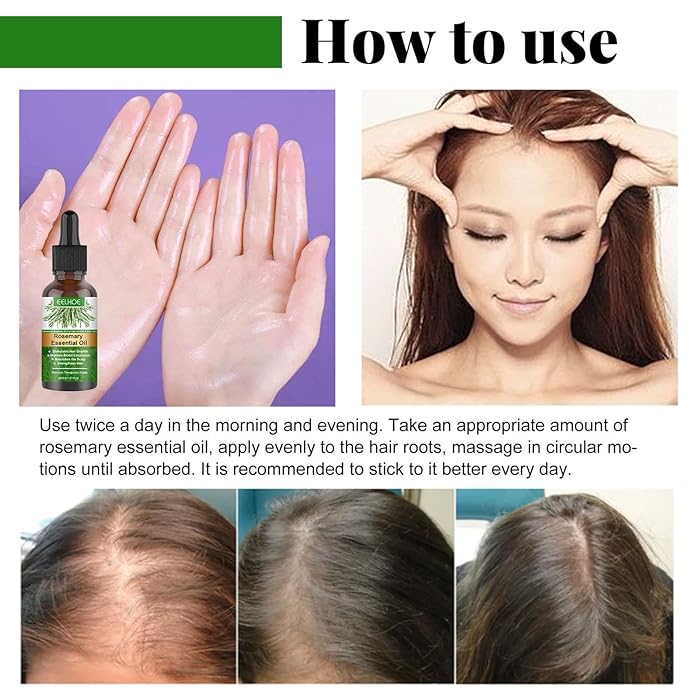 Rosemary Hair Growth Essential Oil Prevent Hair Loss Nourish Scalp Strengthen Hair