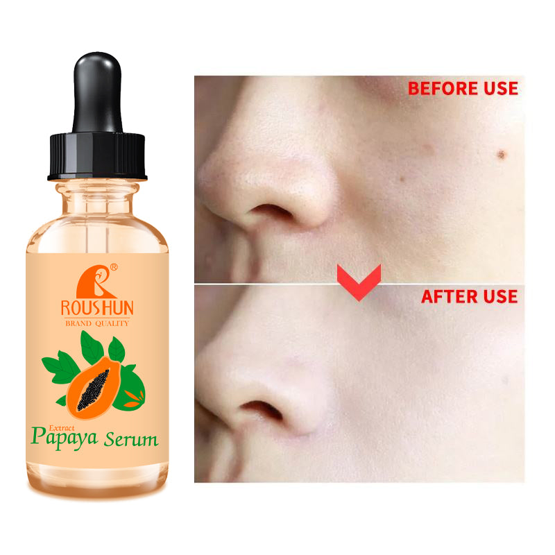 Roushun Papaya Face Serum OEM/ODM, Acne triple clear